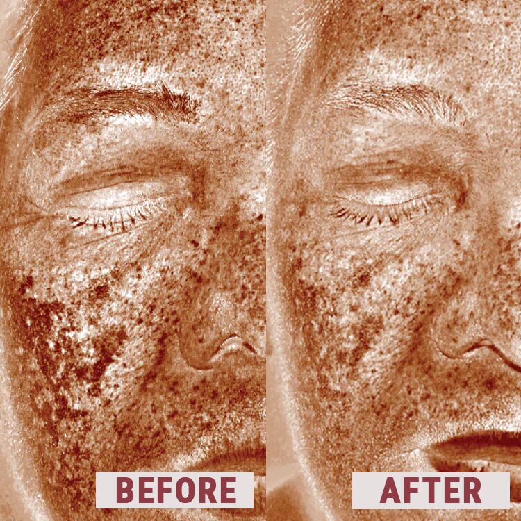 Elevai Enfinity Serum 6 before after comparison 1