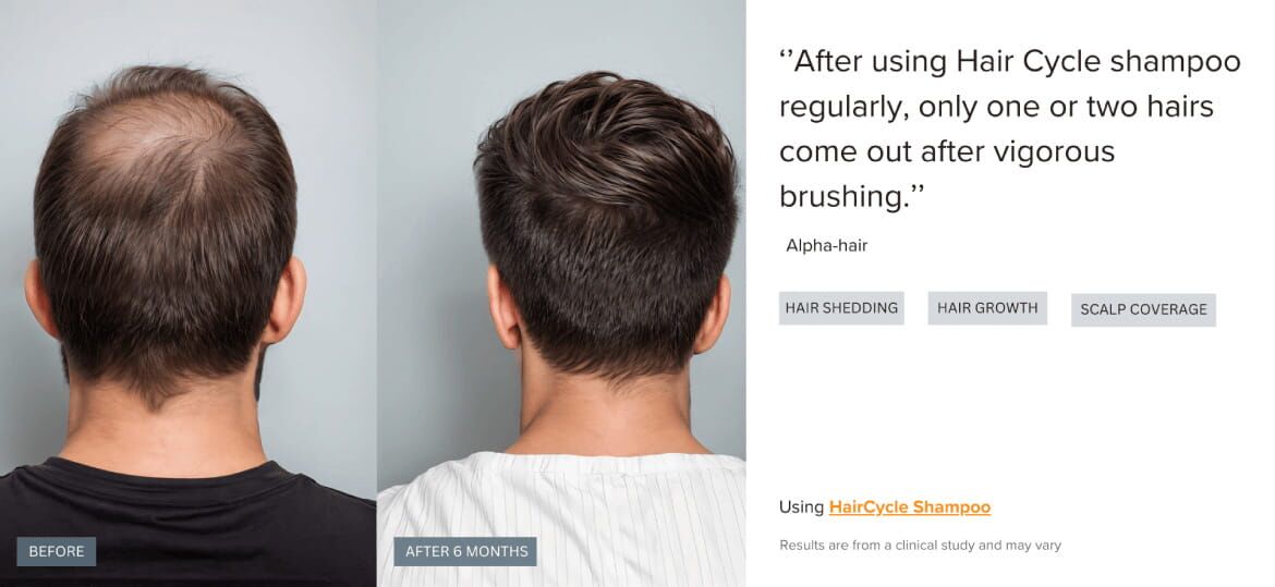before and after 2