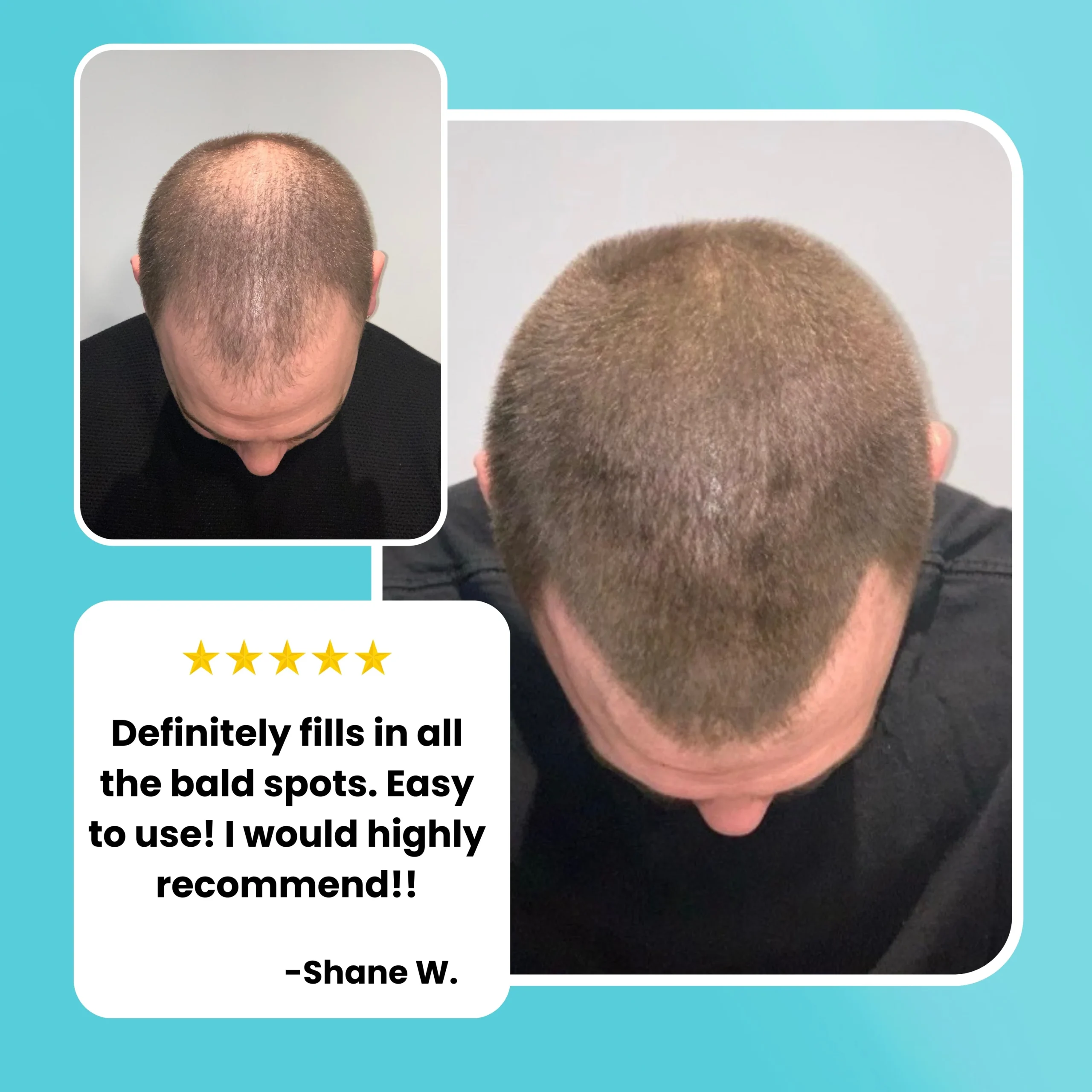 Surethik Hair Thickening Fibers 15G 3 surethik hair thickening fibers – keratin fibers for full hair coverage