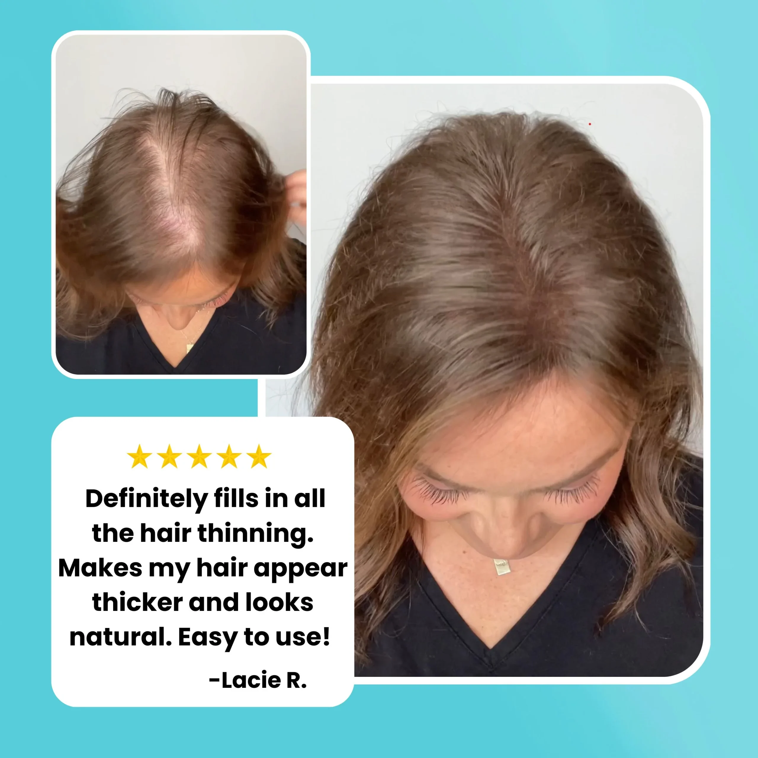 Surethik Hair Thickening Fibers 15G 2 surethik hair thickening fibers – conceal thinning hair instantly